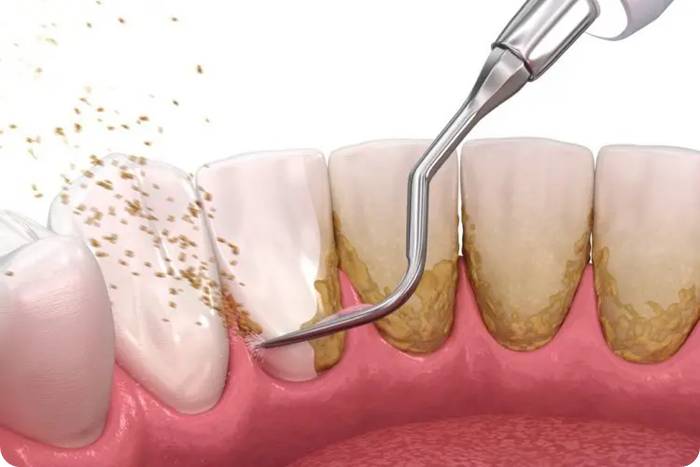 권장 스케일링 주기 