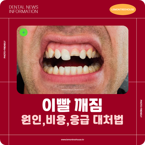 이빨 깨짐 꼭 알아야할 원인, 비용, 응급 대처법